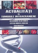 Actualitati in tumorile intracraniene