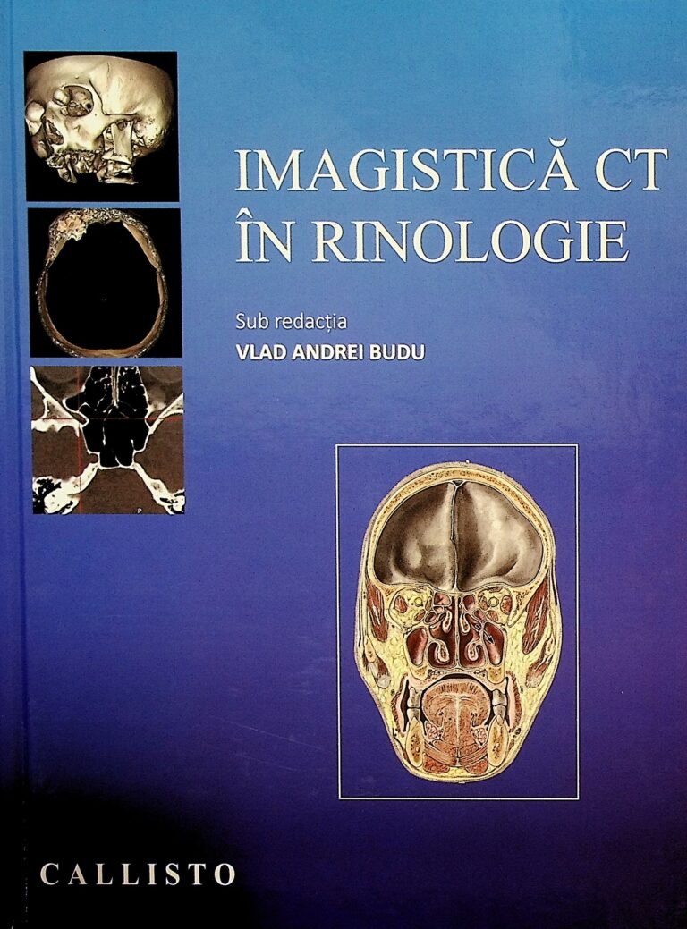 Imagistica CT in rinologie
