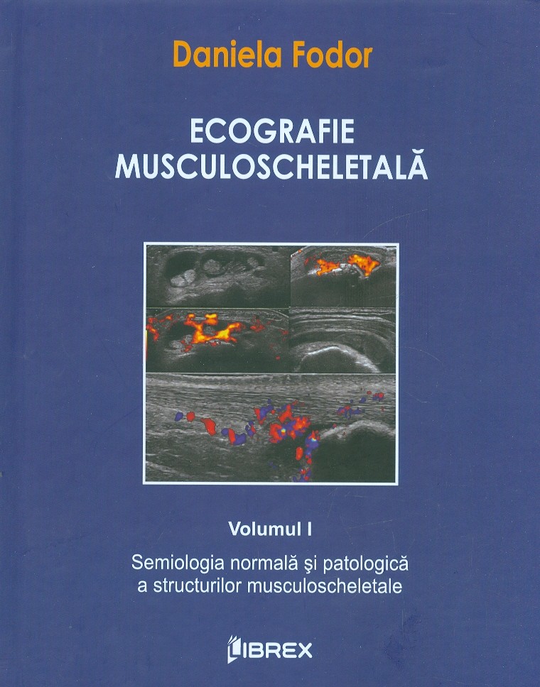 Ecografie musculoscheletala, vol. I - Semiologia normala si patologica a structurilor musculoscheletale