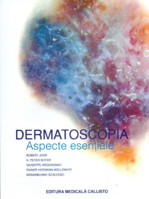 Dermatoscopia - Aspecte esentiale